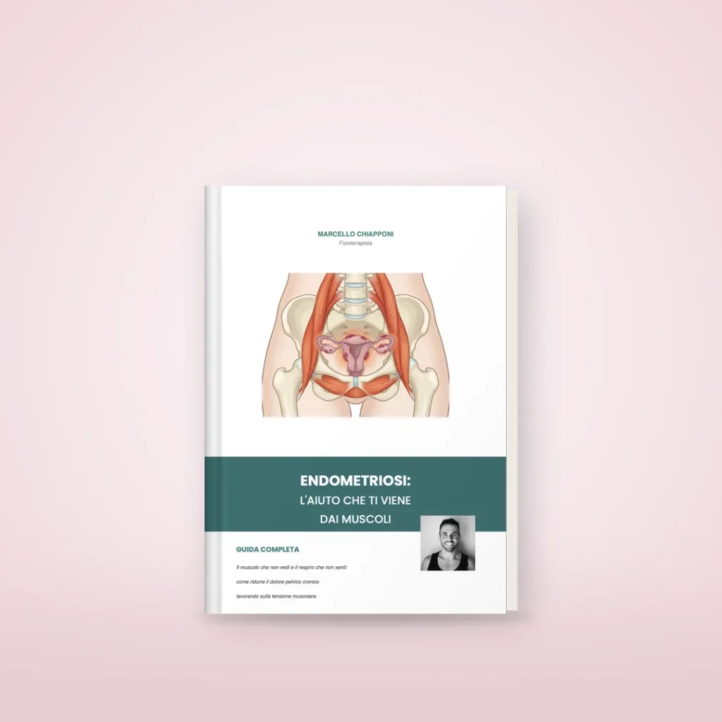 E-book Endometriosi